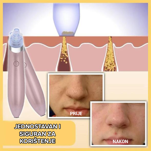 Uređaj za njegu ljepote Facelift