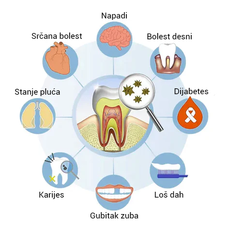 Korektor boje zuba i serum za njegu cakline