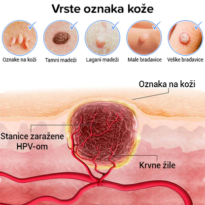 Krema za mrtvu kožu, mrlje i bradavice 2024